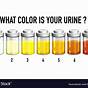 Printable Urine Color Chart