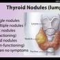Thyroid Nodule Over 1 Cm
