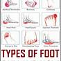 Top Side Foot Pain Chart