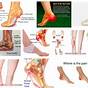 Heel Pain Diagnosis Symptoms