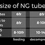 G-tube Size Chart