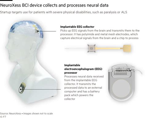 Beijing backs brain implant push to rival Elon Musk’s Neuralink