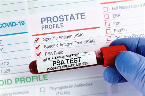 Elevated PSA Causes: 3 Reasons Yours Might Be High - Greater Boston Urology