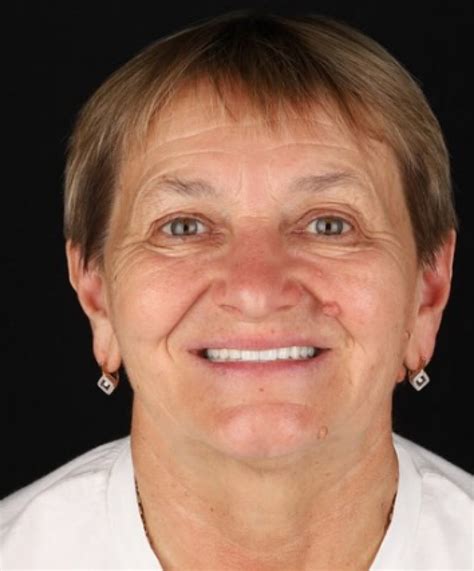 «Design» Ціни, Відгуки - стоматологічна клініка в Запоріжжі | Телефон ...