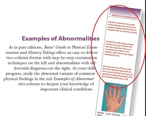 NR509 Advanced Physical Assessment Midterm Exam Study Guide Flashcards ...