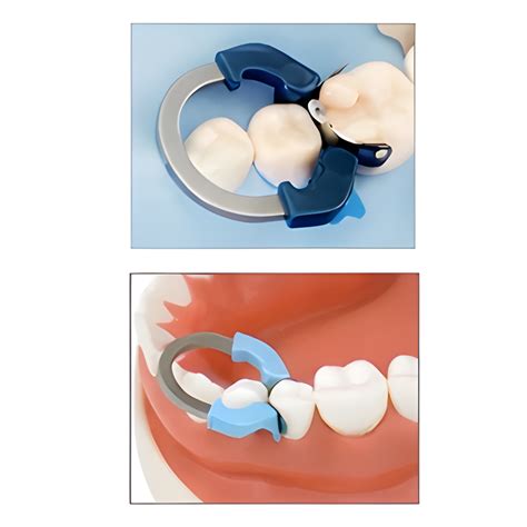 Clamp Ring - Narrow | Unique Product, New Product, Matrix System ...