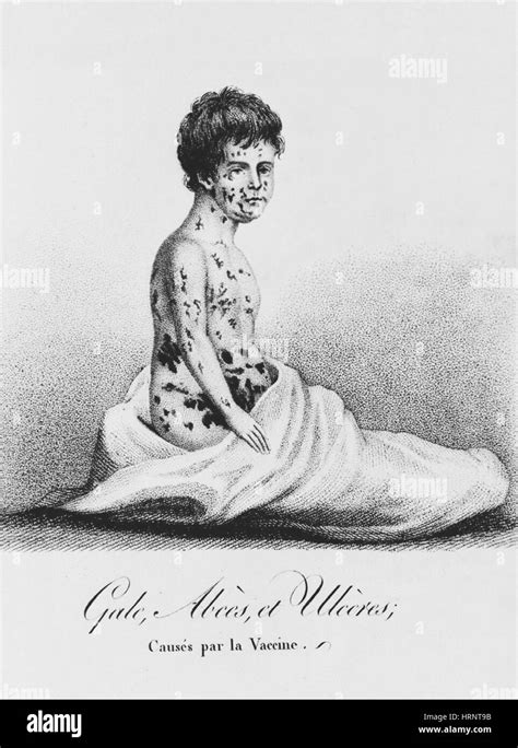 After illness Black and White Stock Photos & Images - Alamy