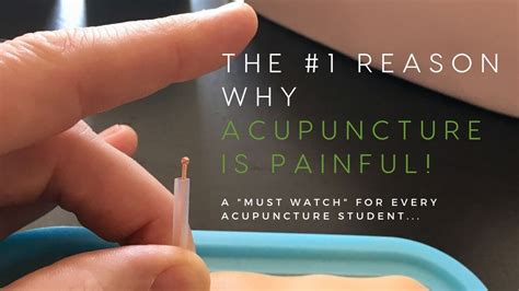 The 1 Reason Why Acupuncture Is Painful Youtube