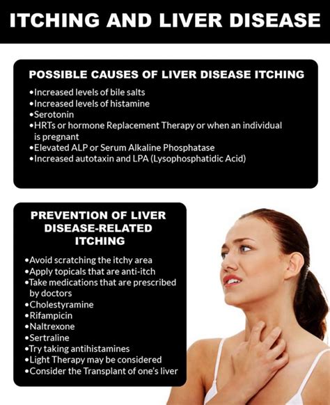 Is Itching A Sign Of Liver Cirrhosis Fatty Liver Disease