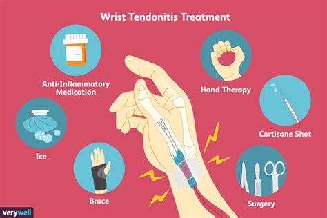 Wrist Tendonitis Signs Causes And Treatments