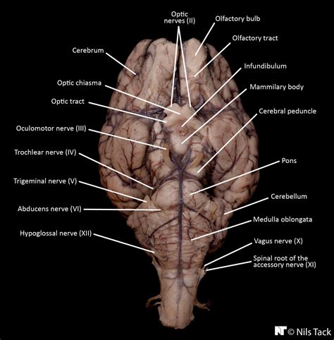 Sheep Brain External Anatomy Ventral