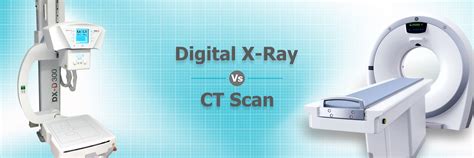 X Ray Vs Ct Scan Differences Pros And Cons Vijaya Diagnostic Centre