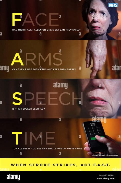 Act Fast Know The Signs Of Stroke Nhs Campaign Posters Produced