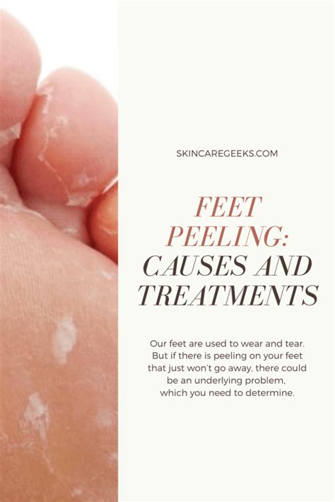 bottom of feet peeling causes and treatments skin care geeks