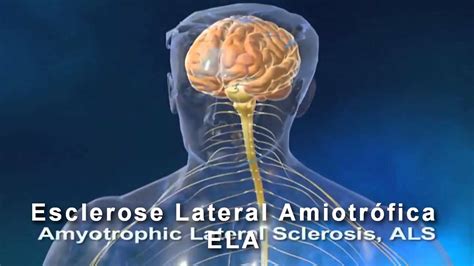 Animação Da Esclerose Lateral Amiotrófica Youtube