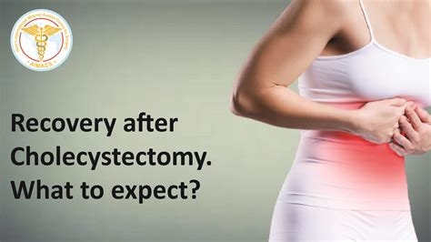 Recovery After Laparoscopic Cholecystectomy What To Expect
