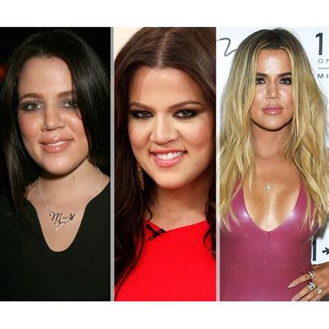 Khloe Kardashians Body Transformation Now To Love