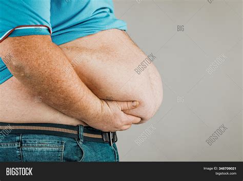 Overweight Persons Image And Photo Free Trial Bigstock