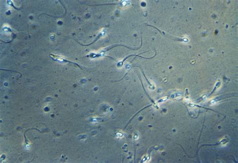 What Does Sperm Motility Mean