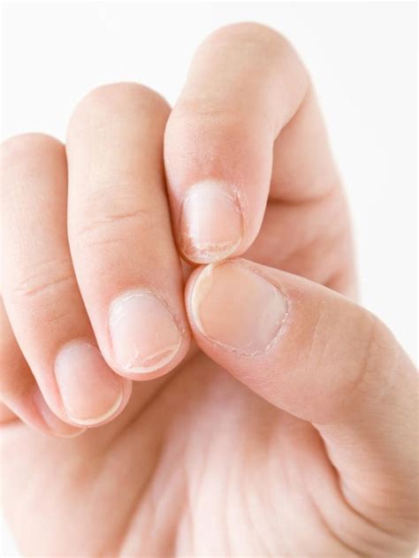 Top 5 Things That Can Cause Brittle Nails Beauty Epic