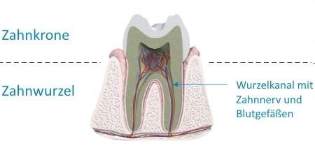 Diese kann verschiedene ursachen haben. Wurzelbehandlung München - AllDent-Zahnzentrum