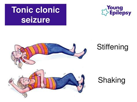 Ppt Ks2 Epilepsy Awareness And First Aid Lesson Powerpoint Presentation