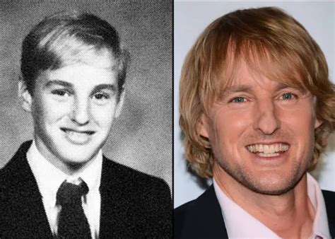 What Happened To Owen Wilson’s Nose Here’s How It Looked Before