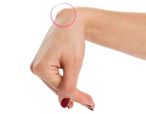 Hand And Wrist Pain Chart