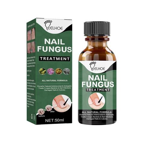 50ml Nail Repair Serum Nail Fungus Treatment Serum Onychomycosis Paronychia Antifungal Nail