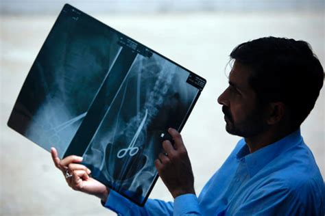 The World S Most Shocking X Rays