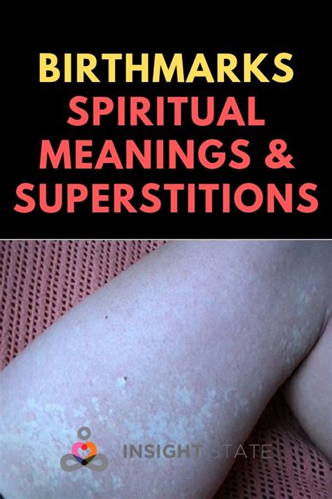 Birthmarks Spiritual Meanings And Superstitions Spiritual Meaning