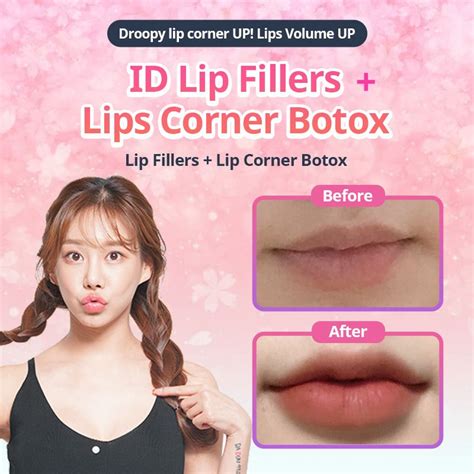 Using Lip Fillers We Strategically Add Volume To Your Lips With Lips