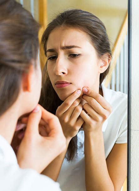 Popping Pimple Stock Photos Pictures And Royalty Free Images Istock
