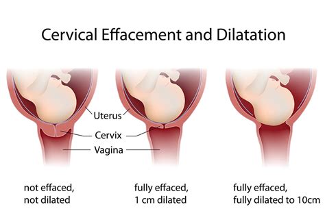 What Happens To Your Cervix In Early Pregnancy Pregnancywalls