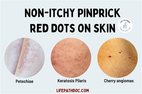 Pinprick Red Dots On Skin But Not Itchy Causes Pictures