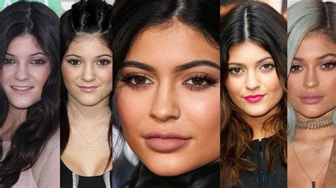 Kylie Jenner’s Face Transformation In Photos See Her New Face That Shocked Everyone