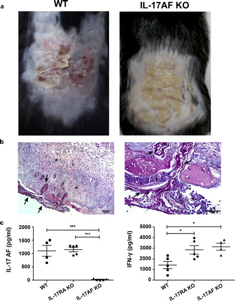 Il 17mediated Immunity Controls Skin Infection And T Helper 1 Response During Experimental