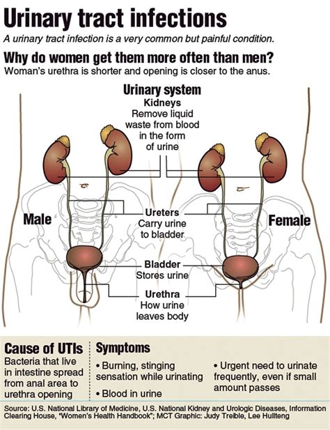 Stop Those UTIs Infection Is Common Among Women Mlive Com