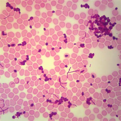 Blood Culture Yeast With Slide