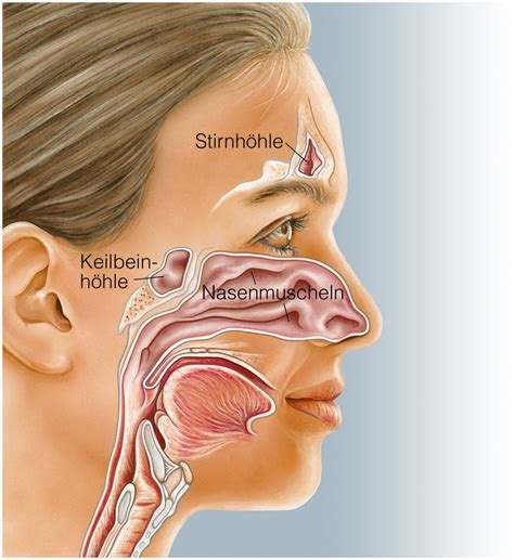 Die entzündete nase im inneren ist als sinusitis bekannt, die nichts anderes als die entzündung der schleimhaut der nasennebenhöhlen ist. Stirnhöhlenentzündung