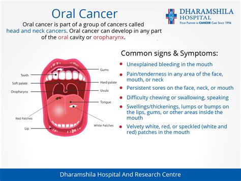 Types Of Mouth Cancer