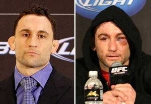 Totally Disfigured Faces Of UFC Fighters Photos KLYKER COM