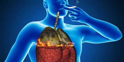 Symptoms Of Lung Cancer In Men And Risk Factors