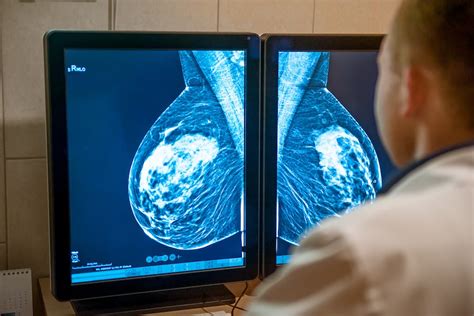 Breast Cancer Screening What Is The Bi Rads Score And What Does It