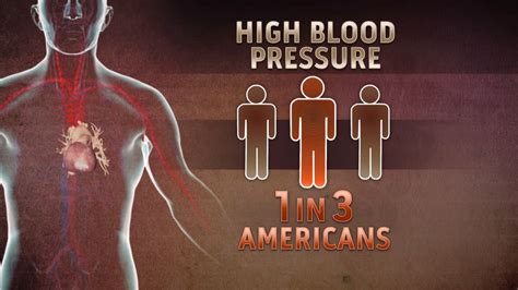 Higher Blood Pressure Threshold Ok In Older Adults Nbc News