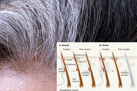 Gray Hair Stress Is The Source