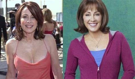 Bristol Palin Plastic Surgery Before And After Photos Celeblenscom