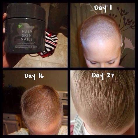 Easy Way To Grow Hair Back Fast Musely