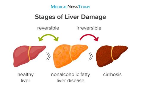 Liver Enzymes Alt And Ast Liver Function Tests Mayo Clinic