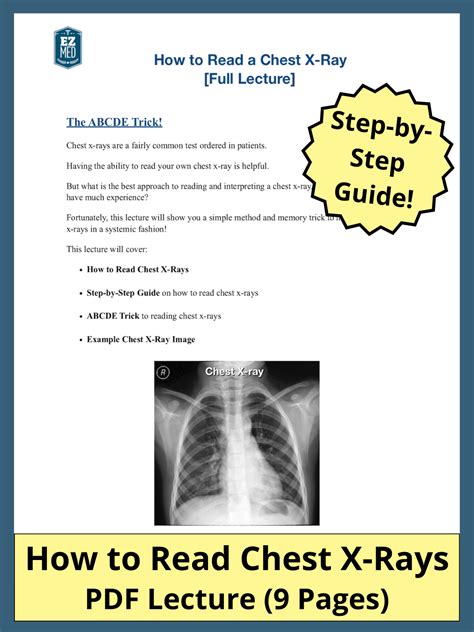 How To Read A Chest X Ray Pdf Abcde Mnemonic Step By Step